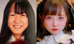 Mengejutkan Wanita Jepang Ini Operasi Plastik sejak Kelas 5 SD, Habiskan Rp 1,1 Miliar 