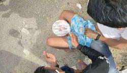 Kronologi Pemotor di Kolaka Tabrak Tanggul hingga Kaki Nyaris Putus