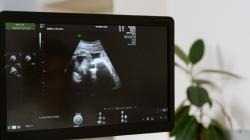 Teknologi yang Menggunakan Ultrasonik dalam Berbagai Bidang, Yuk Simak!