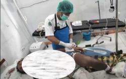 Kronologi Kuli Bangunan Tersengat Listrik saat Renovasi Hotel, Berawal Panjat Bambu Basah