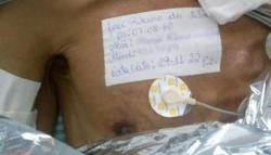 Heboh Dikira Meninggal lalu Dimasukkan ke Kantong Mayat, Pria Ini Ternyata Masih Hidup