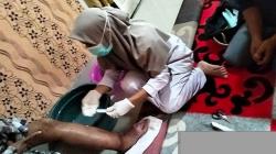 16 Warga Nagan Raya Terserang Penyakit Kaki Gajah Stadium 5, Begini Kondisinya