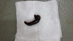 Merinding, Hidung Pemuda Bogor Kemasukan Lintah gegara Cuci Muka di Sawah