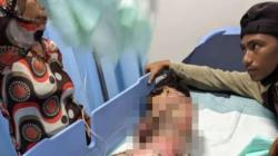 Pilu, Tubuh Bocah 7 Tahun di Lampung Utara Melepuh Tersiram Air Panas 