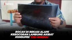 Bocah di Bekasi Alami Kebocoran Lambung Akibat Konsumsi 'Ciki Ngebul'