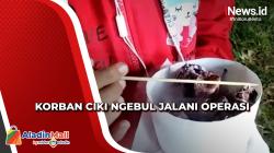 Bocah 6 Tahun Korban Ciki Ngebul di Jember Jalani Operasi Bedah Pencernaan