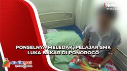 Nyalakan Ponsel dan Tiba-Tiba Meledak, Pelajar SMK Alami Luka Bakar di Ponorogo