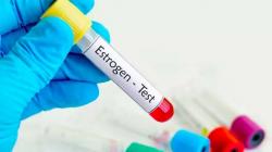 Cara Menurunkan Hormon Estrogen, Salah Satunya Batasi Asupan Kafein