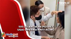 Bikin Pangling, Ini Penampilan Titi DJ usai Operasi Anti-Aging di Korea Selatan