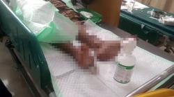 Situbondo Geger, Pegawai Pukesmas Bersimbah Darah Coba Bunuh Diri Pakai Alat Cukur