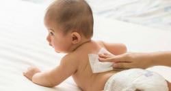 Penting Diketahui, Kiat Menjaga Kesehatan Kulit Bayi dari Risiko Ruam 
