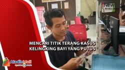 Pimpinan RS Muhammadiyah akan Dipanggil DPRD Sumsel Terkait Putusnya Kelingking Bayi  <