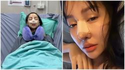 Tak Kapok Oplas Lagi, Lucinta Luna Pamer Hidung Baru: Lunalisa
