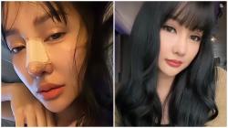 Oplas Lagi, Lucinta Luna Pamer Hidung Baru: Bye Bye Pinokio