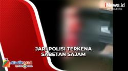 Anggota Polisi Labuan Bajo Terkena Sabetan Sajam Warga, Dua Jarinya Putus