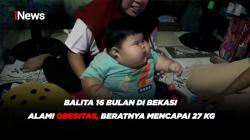 Balita 16 Bulan di Bekasi Alami Obesitas, Beratnya Mencapai 27 KG 