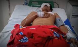 Petani Karet di Muaro Jambi Diserang Beruang, Wajahnya Dicakar Kini Terancam Buta