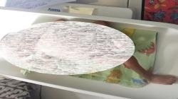  Miris, 2 Balita di Karawang Idap Gizi Buruk Parah