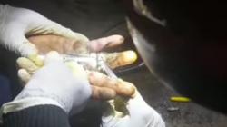 Kasus Terjepit Cincin Sering Terjadi di Garut, Paling Ngeri Jari Membusuk<