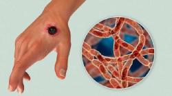 Senjata Biologis Pertama dalam Sejarah Manusia