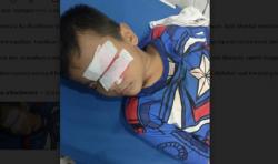 Gegara Perang Sarung, Bocah SD di Balikpapan Terancam Buta<