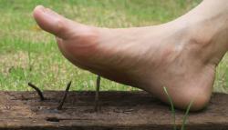 Cara Mengobati Kaki Kena Paku dengan Bawang Merah, Aman atau Justru Berbahaya?