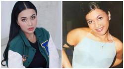 Denada Ungkap Alasan Lakukan Oplas di Korea Selatan: Insecure Itu Pasti