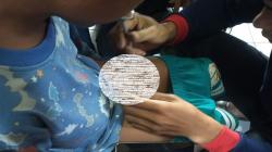 Gegara Kemaluan Terjepit Ritsleting Berjam-jam, Bocah Dievakuasi ke Damkar Cimahi<