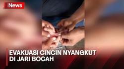 Petugas Damkar di Gunungkidul Evakuasi Cincin Nyangkut di Jari Bocah 14 Tahun