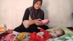 Pilu, Bayi 8 Bulan di Tasikmalaya Derita Hidrosefalus, Butuh Uluran Tangan Dermawan<
