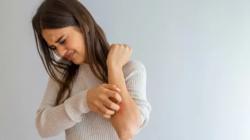 Catat 4 Makanan Tidak Boleh Dimakan saat Kurap, Fatal Akibatnya