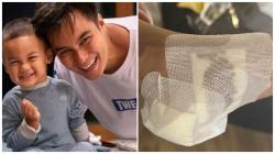 Baim Wong Bagikan Kabar Sedih, Kiano Tiger Wong Kena Musibah: Minta Doanya