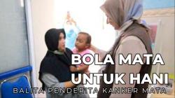 Bola Mata Palsu untuk Hani, Balita Penderita Kanker Netra di Jember