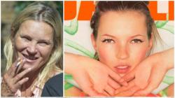 Apa Kabar Kate Moss Supermodel Dunia, Wajahnya Berubah Drastis akibat Merokok