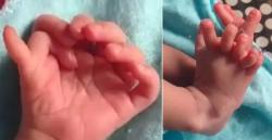 Viral Bayi Lahir Memiliki 26 Jari Tangan dan Kaki, Keluarga Percaya Reinkarnasi Dewi Hindu