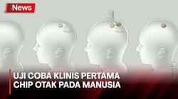 Neuralink Dapat Izin untuk Uji Klinis Pertama Chip Otak pada Manusia