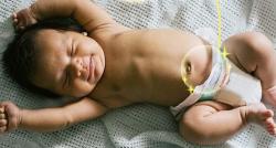 Ketahui Cara Merawat Tali Pusat Bayi Baru Lahir, Jangan Sampai Terkontaminasi!