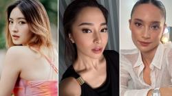 7 Artis Cantik Tetap Percaya Diri meski Berjerawat, Nomor 5 Pernah Nangis Berhari-hari 