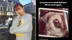 Isyana Sarasvati Bagikan Kabar Duka, Alami Keguguran saat Usia Kandungan Baru 8 Minggu