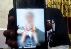 Begini Kondisi Terkini Bocah 7 Tahun di Kota Malang yang Disiksa Keluarganya