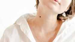 Ternyata Ini 5 Arti Tahi Lalat di Leher, Salah Satunya Penyayang