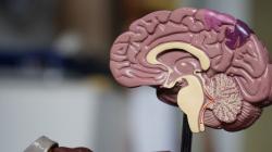 Impian Elon Musk Gabungkan Manusia dan AI, Ini Langkah Selanjutnya Usai Sukses Uji pada Hewan