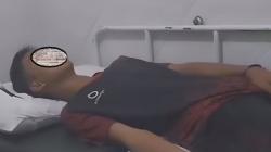 Viral Santri di Palembang Diduga Dibakar Teman saat Tidur, Luka di Tangan<