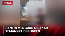 Heboh! Santri di Palembang Ngaku Dibakar Temannya, Pihak Ponpes Membantah