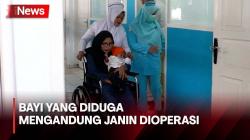Bayi 5 Bulan yang Diduga Mengandung Janin di Padang Ternyata Alami Tumor