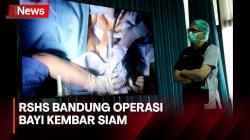 Hasan, Bayi Kembar Siam Meninggal Usai Opersasi Pemisahan di RSHS Bandung<