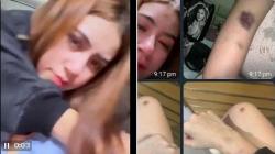 Polisi Selidiki Dugaan Penganiayaan Rinoa Aurora yang Viral, Laporan sejak 8 November