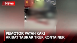 Pengendara Motor Alami Patah Kaki Setelah Tabrak Truk Kontainer
