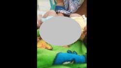 Ngeri, Bayi di Lebak Banten Digigit Monyet Liar, Usus sampai Keluar<