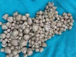 Ngeri, 300 Batu Ginjal Dikeluarkan dari Perempuan Ini akibat Sering Minum Boba